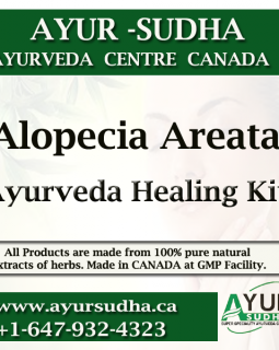 Alopecia Areata Ayurvedic Medicine in Canada. Ayurveda Products Toronto