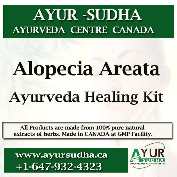 Alopecia Areata Ayurvedic Medicine in Canada. Ayurveda Products Toronto