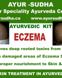 Eczema Ayurvedic treatment in Canada.