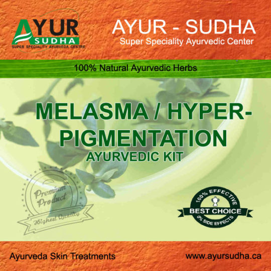 Melasma treatment in Ayurveda at AyurSudha Skin Clinic.