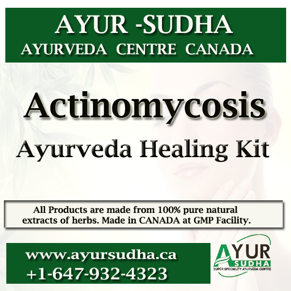 Actinomycosis Ayurvedic Medicine treatment in Canada, USA, UKs