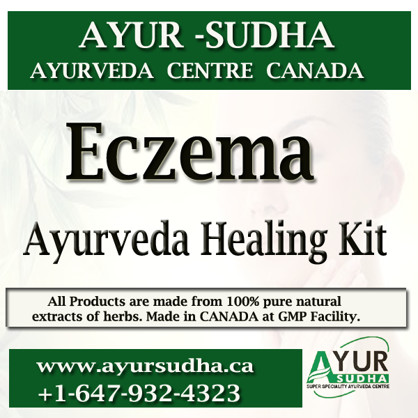 Eczema Ayurvedic Medicine in Canada. Ayurveda Products in Brampton