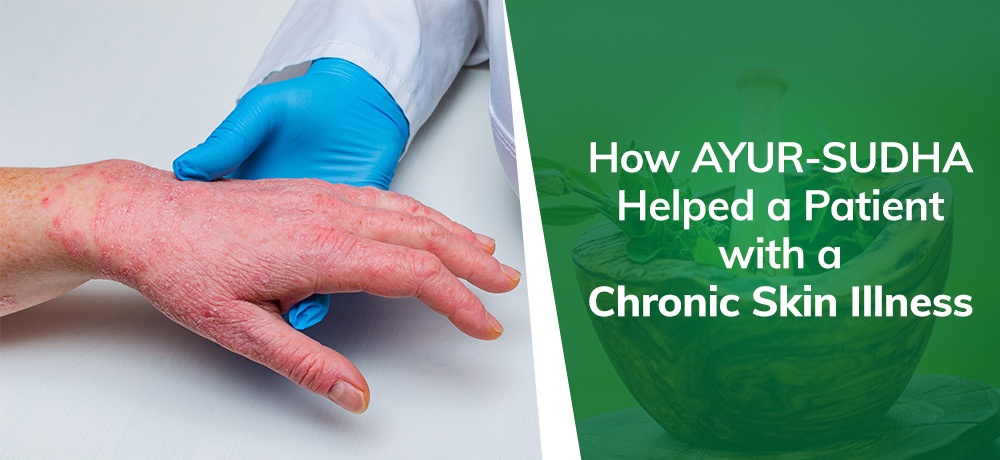 HOW AYUR-SUDHA HELPED A PATIENT WITH A CHRONIC SKIN ILLNESS