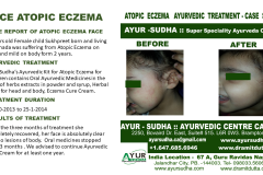Slide13
