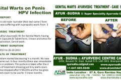 Slide2