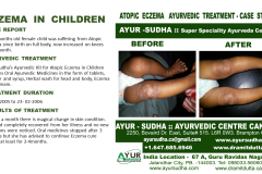 Slide3