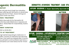 Slide5