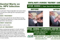 Slide6