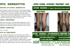 Slide7