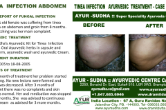 Slide8