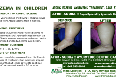 Slide9