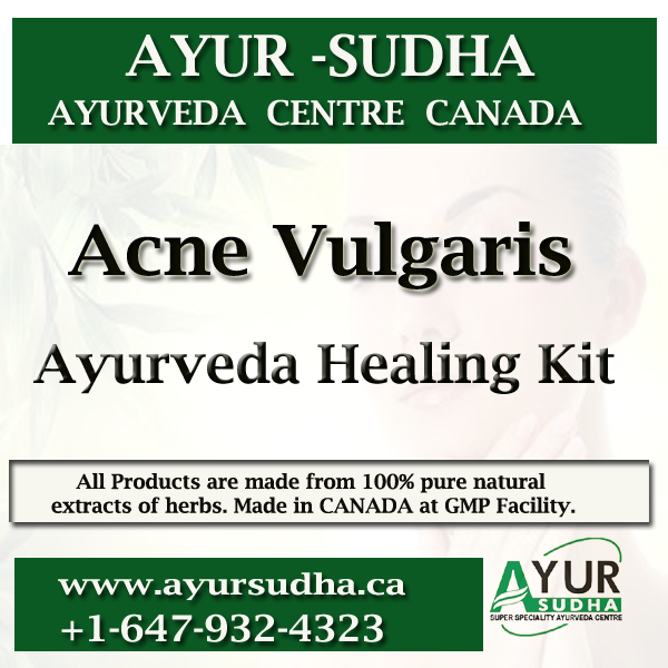 Acne Ayurvedic Medicine treatment in Brampton, Canada.