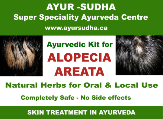 Alopecia Areata Ayurvedic Medicine in Brampton. Skin Clinic