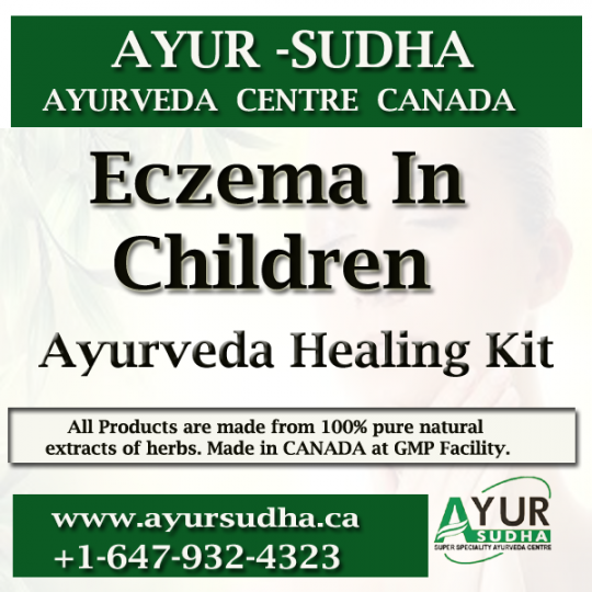 Eczema children. Ayurvedic Medicines Treatment Canada.