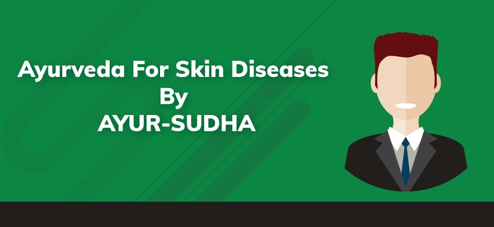 AYURVEDA FOR SKIN DISEASES BY AYUR-SUDHA